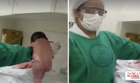 Doctor: Viral video of newborn 'walking' is normal