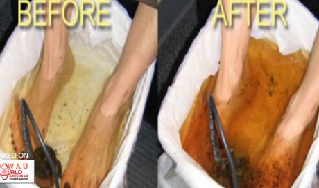 How To Detox Through Your Feet? The Amazing Foot Bath!