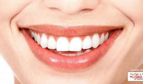 8 Useful Ways For Whitening Your Teeth Naturally