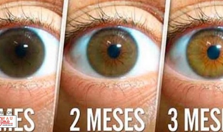 Natural Remedy For Cleaning Your Eyes and Improving Vision in Only 3 Months: Here is What You Need to Do to Avoid Surgery!