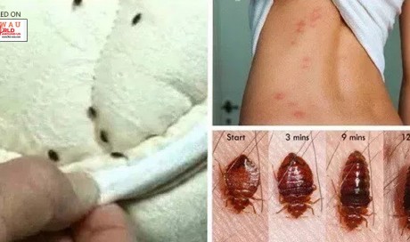 These Bugs Reside In Your Bed And Harm Your Lungs And Back While You Sleep: Learn How To Destroy Them Quickly, Easily, And Naturally!