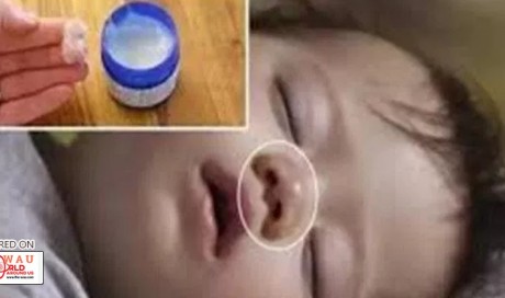 Mom Applied This Remedy To Her Baby,But Shortly After The Baby Died. Be Careful With This!!