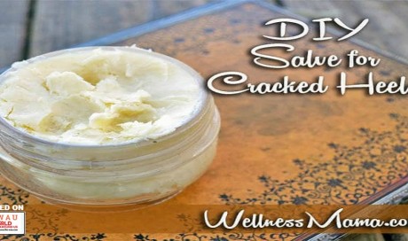 Soothing Diy Salve for Cracked Heels