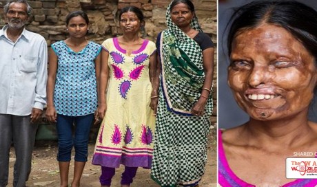Man Attacks Wife And Daughters With Acid 25 Years Back. They Still Live Together.