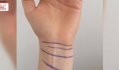 What the lines on your wrist tell you about your personality
