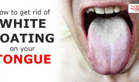 How To Remove White Patches On Your Tongue With 1 Ingredient