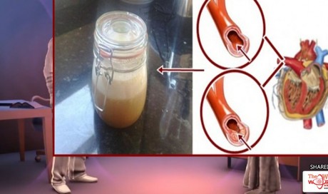 Say Goodbye To High Blood Pressure, Cholesterol, And Triglycerides With This Powerful Drink!