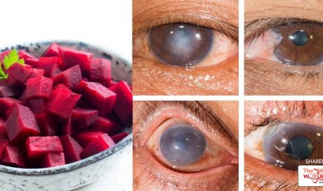 Juice These 3 Superfoods To Detoxify Your Liver And Improve Vision