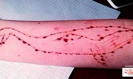 Blue whale challenge not a game but a death trap: Victim recounts experience