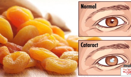 Start Eating These 26 Foods The Moment You Notice Your Vision Getting Worse