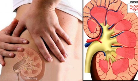 Stop Making These 8 Mistakes That Damage Your Kidneys