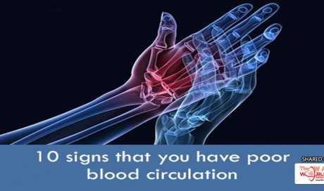 10 Warning Signs of Poor Blood Circulation