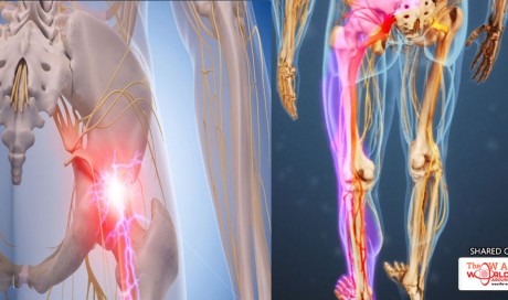 The Hidden Muscle Causing Your Sciatica Pain And 2 Easy Stretches For Instant Relief