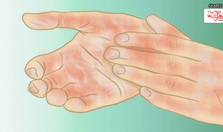 Do You Suffer From Poor Circulation? Here's How to Solve the Problem in Less Than 20 Minutes!