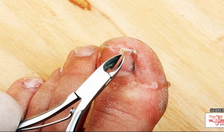The Right Way to Clip Your Toenails