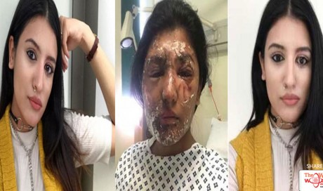 Acid Attack Survivor Shares New Selfie Of Remarkable Recovery Saying It’s ‘Time To Stop Hiding’