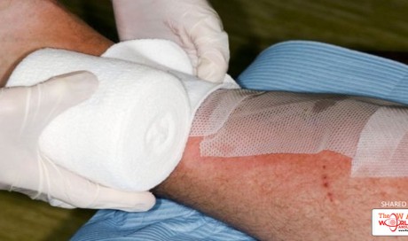 Daytime wounds 'heal more quickly'