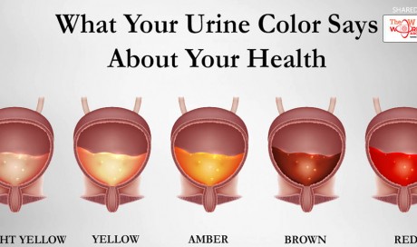 Here's What The Color of Urine Says About Your Health