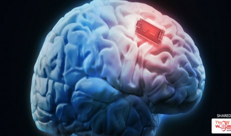 For The First Time Ever Scientists Have Boosted Human Memory With a Brain Implant