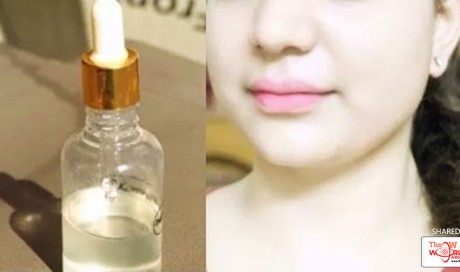 My Friend Gifted Me Her Secret Facial Oil, It Removed All Wrinkles, Dark Spots From My Face in Just 5 Nights