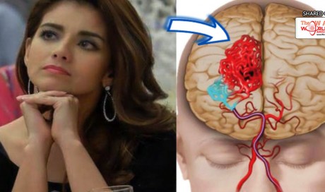 The Health Condition That Took The Life of Isabel Granada, Learn How To Prevent Aneurysm