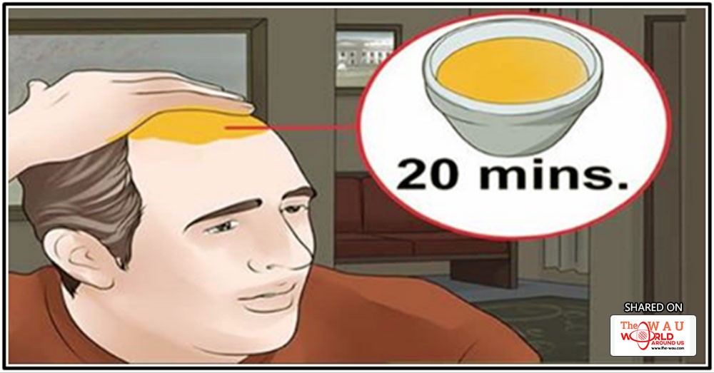 Grow Back Your Hair Naturally Just By Following These Simple Steps
