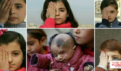 Picture of Syrian baby who lost eye in Assad attack prompts online solidarity