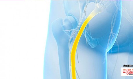 11 Effective Solutions For Sciatica Pain