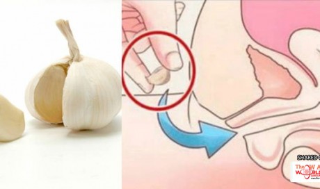 12 Unbelievable Health Benefits Of Garlic