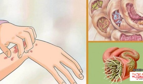 19 Signs Parasites Are Residing In Your Body – These Herbs Can Help Destroy Them.