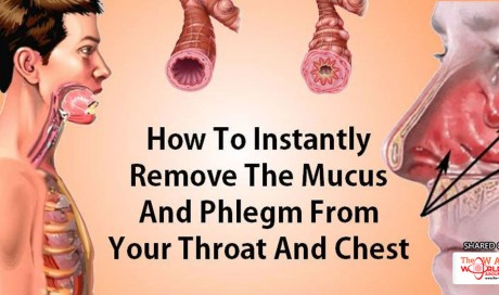 How to remove mucus and phlegm from your throat and chest instantly