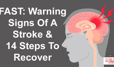 FAST: Warning Signs Of A Stroke & 14 Steps To Recover
