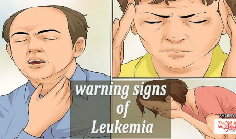 These are the warning signs of Leukemia that most people ignore
