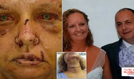 Mother-of-three's shocking injuries after husband she met on Plenty of Fish dating website beat her unconscious and tied her up for watching Britain's Got Talent  