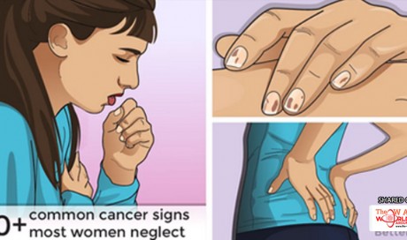 10+ Common Cancer Signs Most Women Neglect