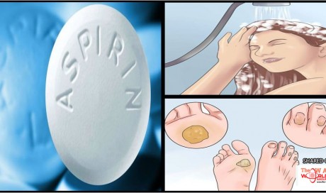9 Surprising Uses for Aspirin You Never Knew Existed