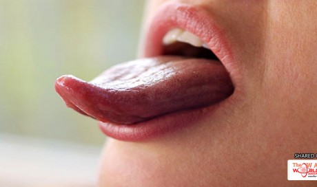 Common Causes of Swollen Tongue
