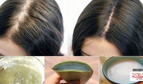 7 Home remedies that can help stop hair-fall naturally