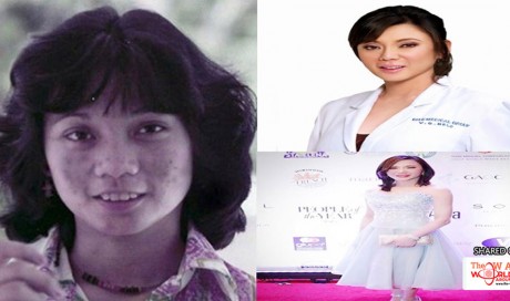Dr. Vicki Belo’s Shocking Transformation; Younger Years To Present