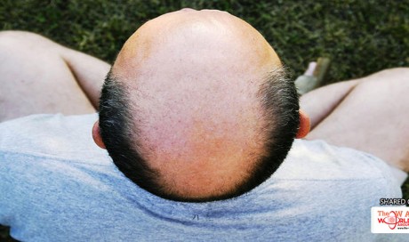 3 Easy Ways to Shave Your Bald Head