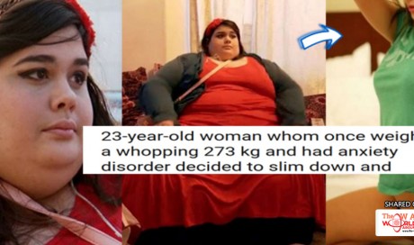273-kg Woman Who Was Called Obese All Times Decides To Slim Down.