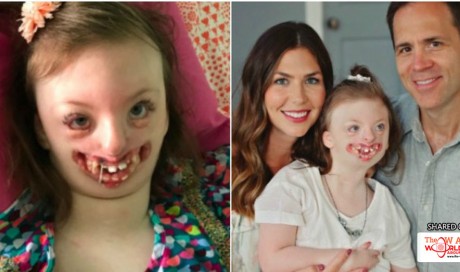 Mom Fights Back After Cruel Troll Uses Disabled Daughter’s Image To Promote Abortion