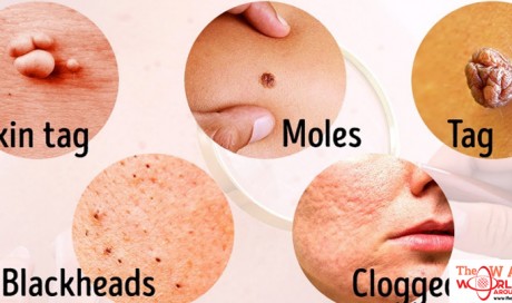 8 Serious Diseases That Are Signaled By Our Skin