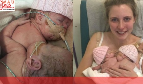 Mom Shares Touching Photos Of Her Premature Baby's Goodbye Hug For Her Dying Twin Sister