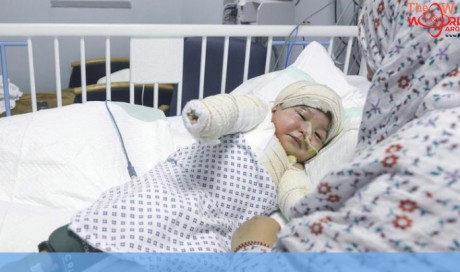 Emirati toddler badly burned in cooking accident helped after appeal to leadership
