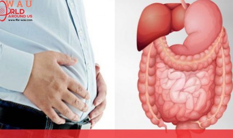 8 Causes Of Bloated Stomach and Natural Remedies
