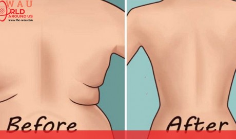 Try the World's 5 Easiest Exercises for Back Fat and Underarm Flab