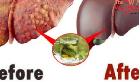This Plant Can Help Cleanse the Liver, Kidney, and Body From Toxins
