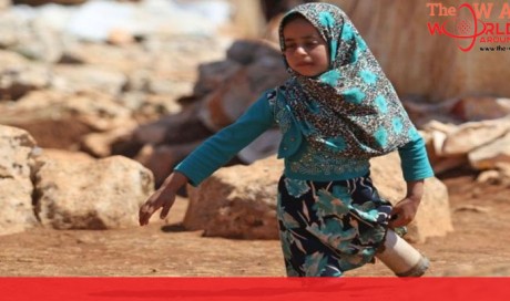 This 8-YO Syrian Girl Walks On Tin Cans As Prosthetic Legs That Her Father Made For Her
