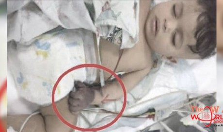 9 months old infant’s hand paralyzed due to the wrong injection in a Saudi Hospital
